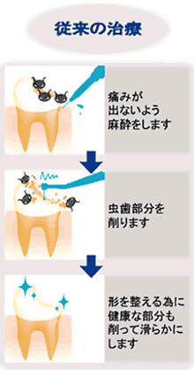 従来の治療