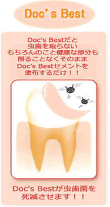 メディケア歯科クリニックの理念でもある「予防」