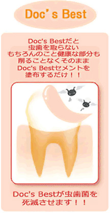 メディケア歯科クリニックの理念でもある「予防」